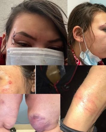 Braided Warriors Assaulted by Police